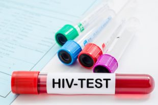 HIV-VIH-Sida-dépistage