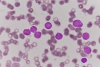 maladies rares