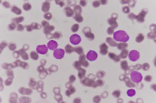maladies rares