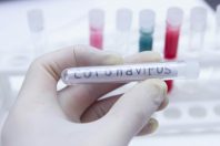 coronavirus covid-19